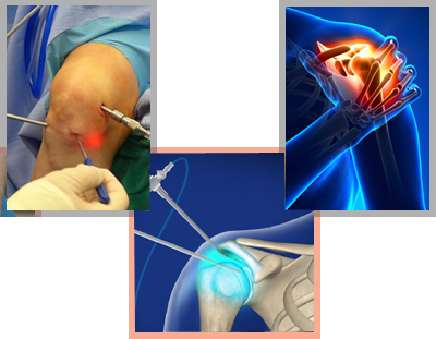 Arthroscopic Surgery